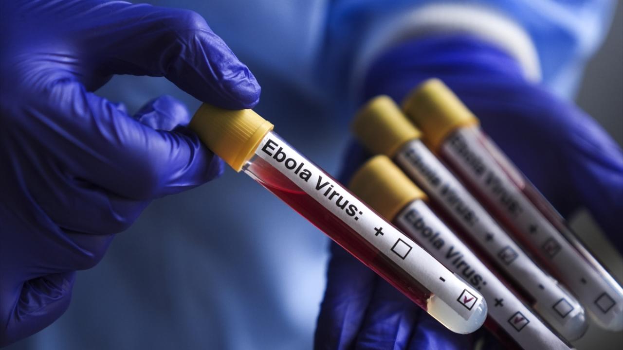 Fransa’da Ebola vakası görüldü